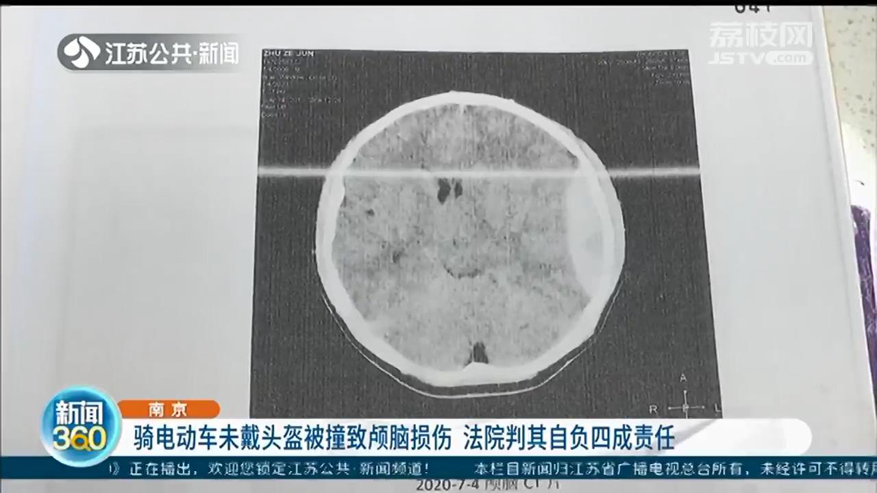 戴好头盔！南京一男子骑电动车未戴头盔被撞致颅脑损伤 法院判其自负四成责任