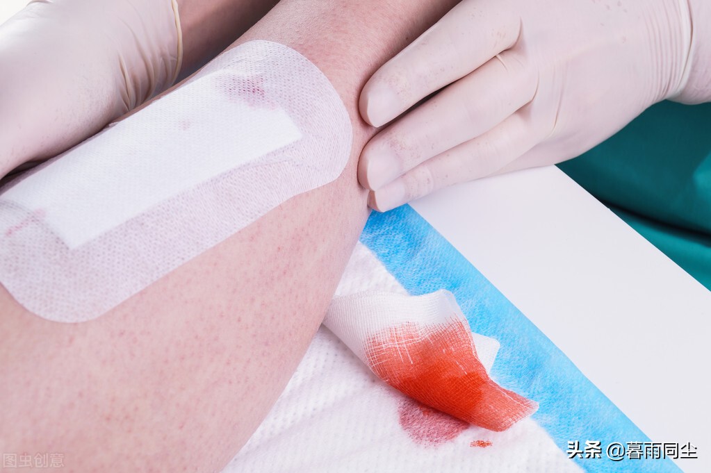 野外最常见6大伤病，背包客、户外工作者要学会（DIY）医疗应急包