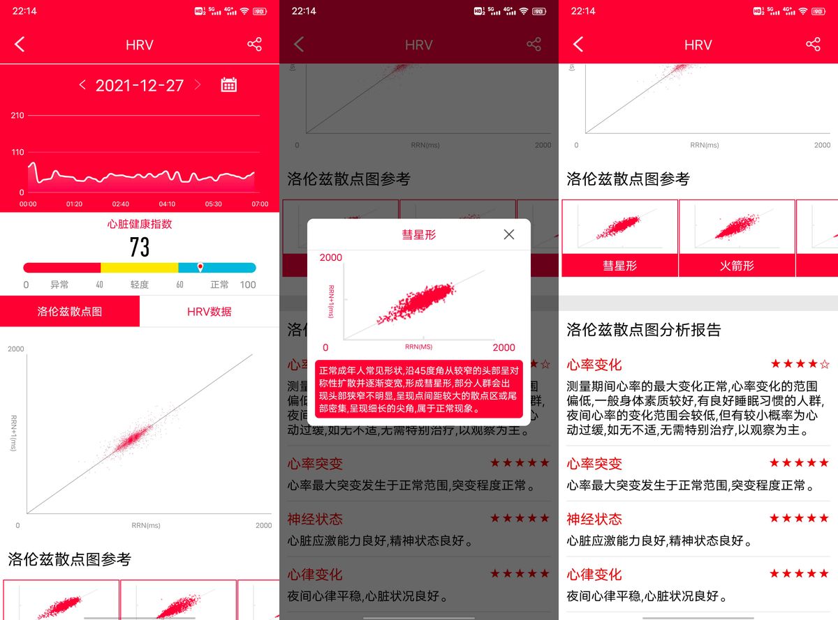 dido Y2智能手环体验评测：准医疗级精度，心电测量更准