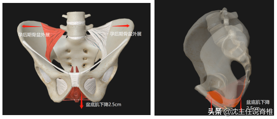 经常臀部酸痛，是腰椎间盘突出吗？该如何应对？