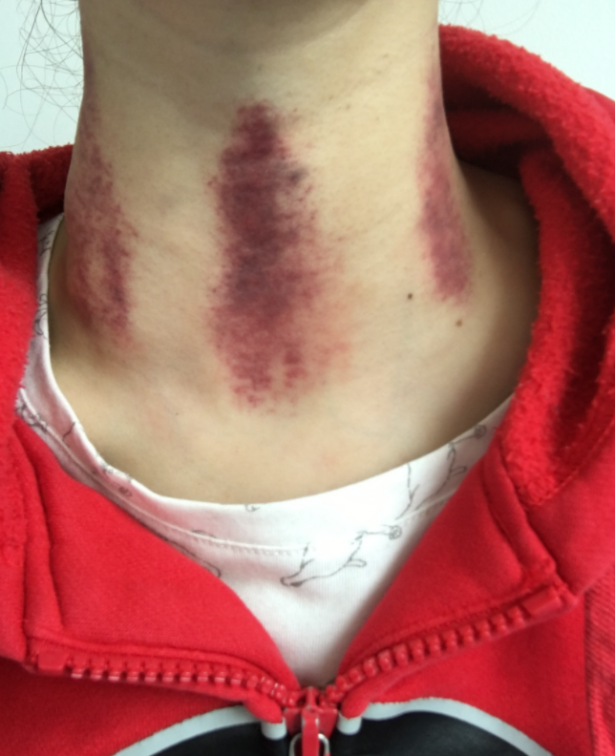 26岁离开人世，被家人“吸血”一辈子的徐婷，到底经历了什么？