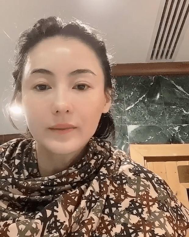 瘦到病态、整容成瘾，痴迷于少女人设，内娱的畸形审美太可怕