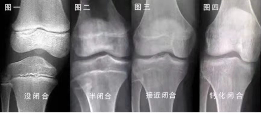 孩子个子偏矮，还能追上同龄人吗？赶在这个时间前面，还有机会