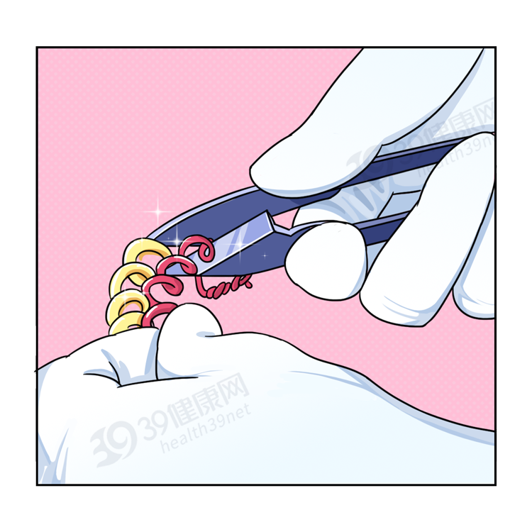 男性结扎和女性结扎，哪个伤害更大？男性结扎会降低性能力吗？