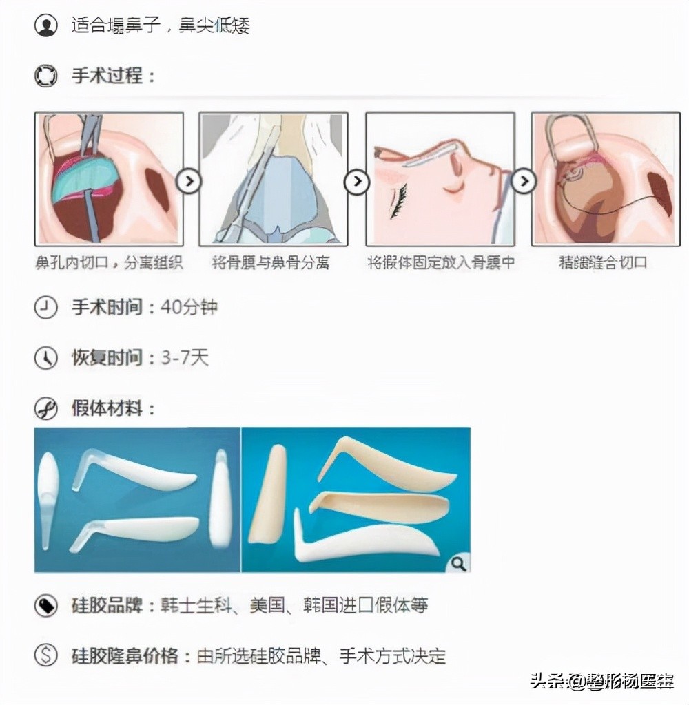 隆鼻整形：细讲隆鼻的利弊、风险与​隆鼻的效果持续性等问题