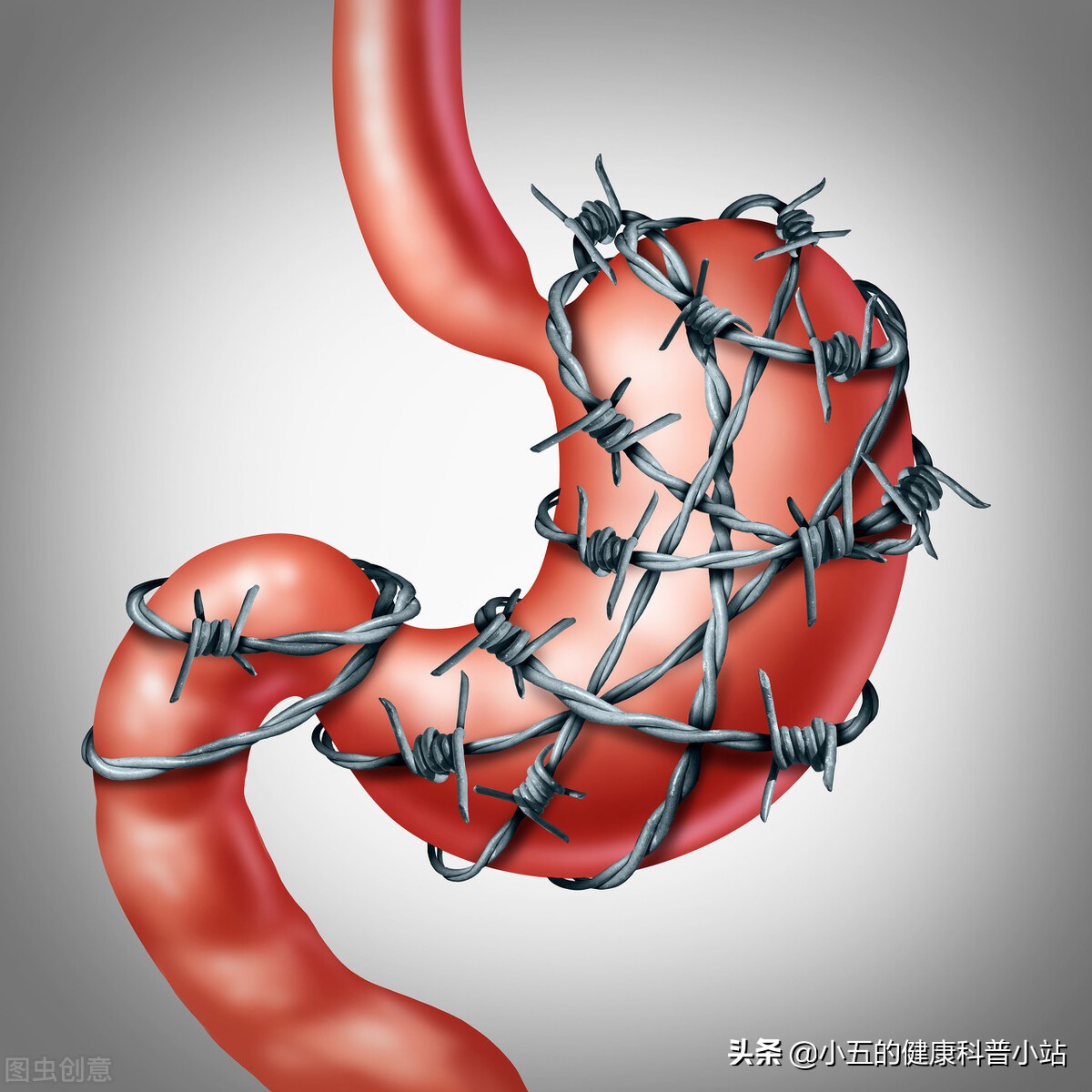 慢性萎缩性胃炎治疗方案及日常护理要点