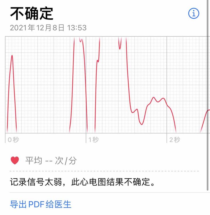 苹果手表心电图苹果手表心电图有哪些细节