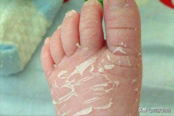 新生儿独有的5个“怪”现象，爸妈别着急，宝宝只是长得有点儿快