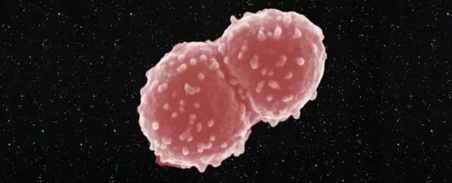 宇宙也杀不死的十大生物：“长生不死”活上亿年，脑袋没了也能活