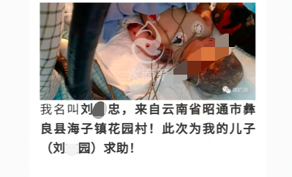 追踪 | 云南1岁男婴烧伤父亲卷善款失联 家属称孩子目前情况稳定