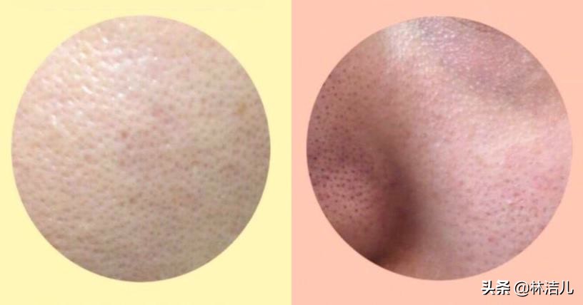 不仅拥有盛世美颜，张雨绮景甜怼脸拍更是零毛孔，皮肤白到发光了