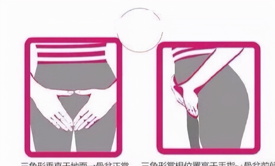 你们要的干货又来了：卷尾骨提耻骨让骨盆端正，你真的做对了吗？