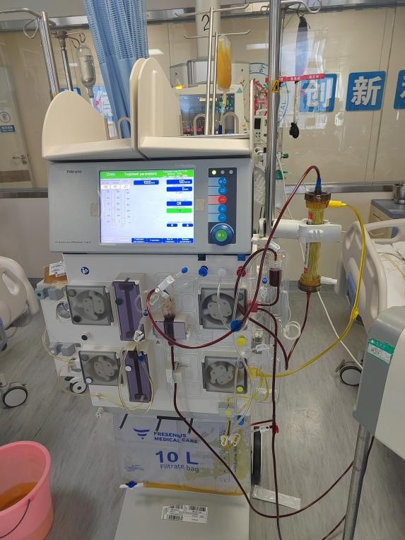 西安市红会医院重症医学科利用人工肝技术救治危重患者