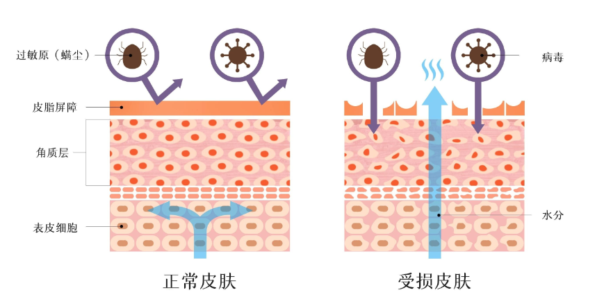 想要美白、抗老？别着急，先把皮肤屏障修复好