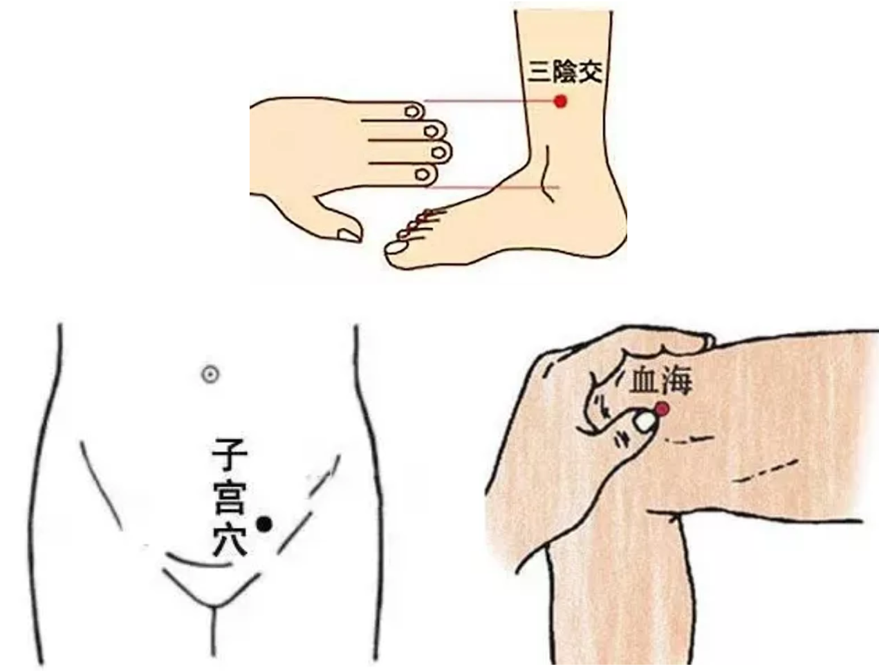 女生痛经到底有多痛？别慌！中医缓解小妙招了解一下