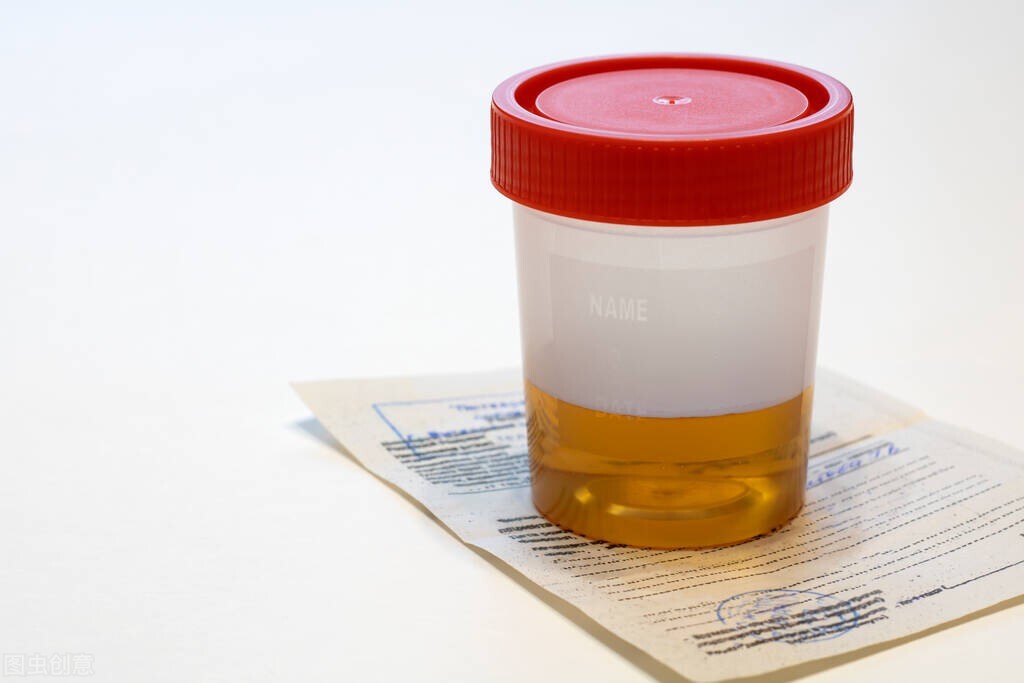 尿蛋白多少是正常值(体检查出来蛋白尿) - 青木春