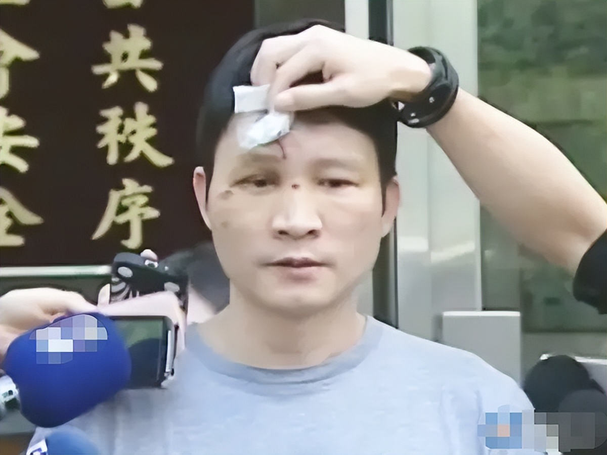 52岁戏骨被控欠债157万，无奈直播变卖家产，此前暴瘦肺部长异物