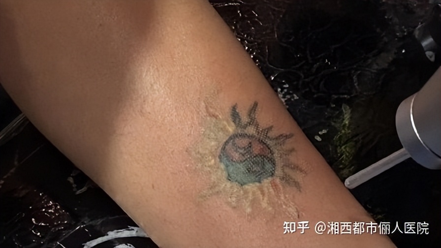 「纹身价格」洗纹身多少钱（洗纹身注意事项有哪些）