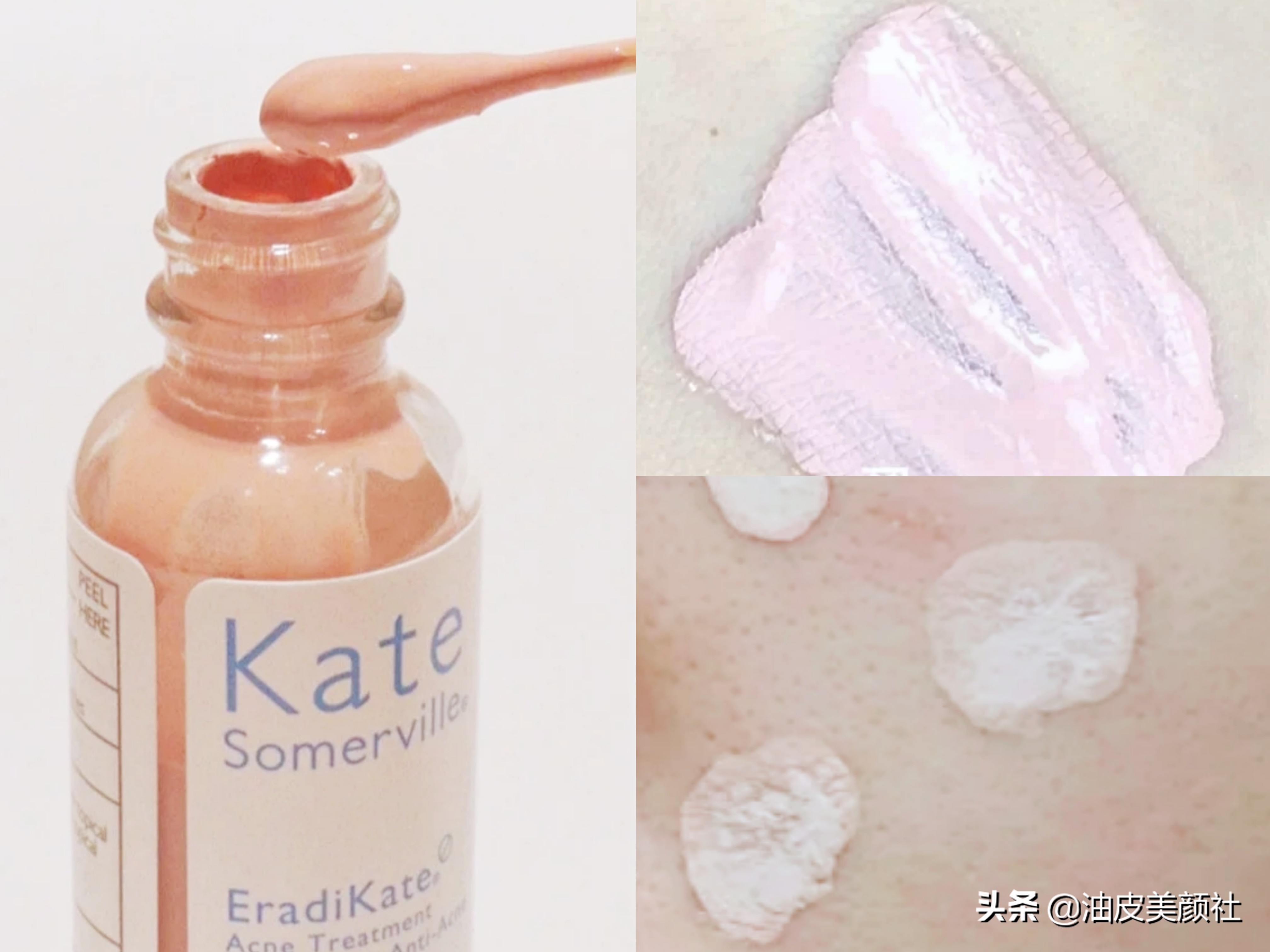 kate somerville祛痘精华液 小粉瓶