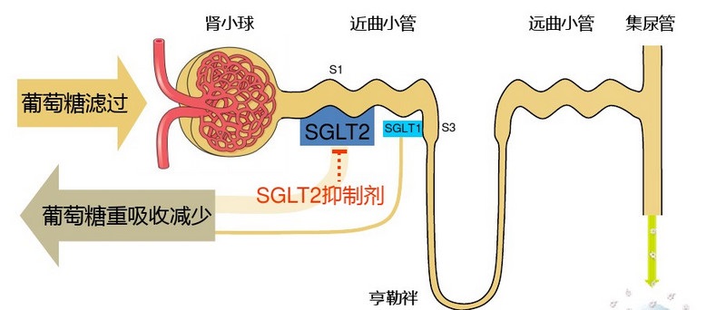 降糖药达格列净有6大优点，但长期服用得注意6件事