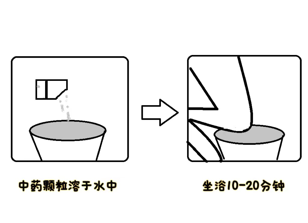仁医科普| 菊花疼不一定是痔疮，警惕肛周脓肿！
