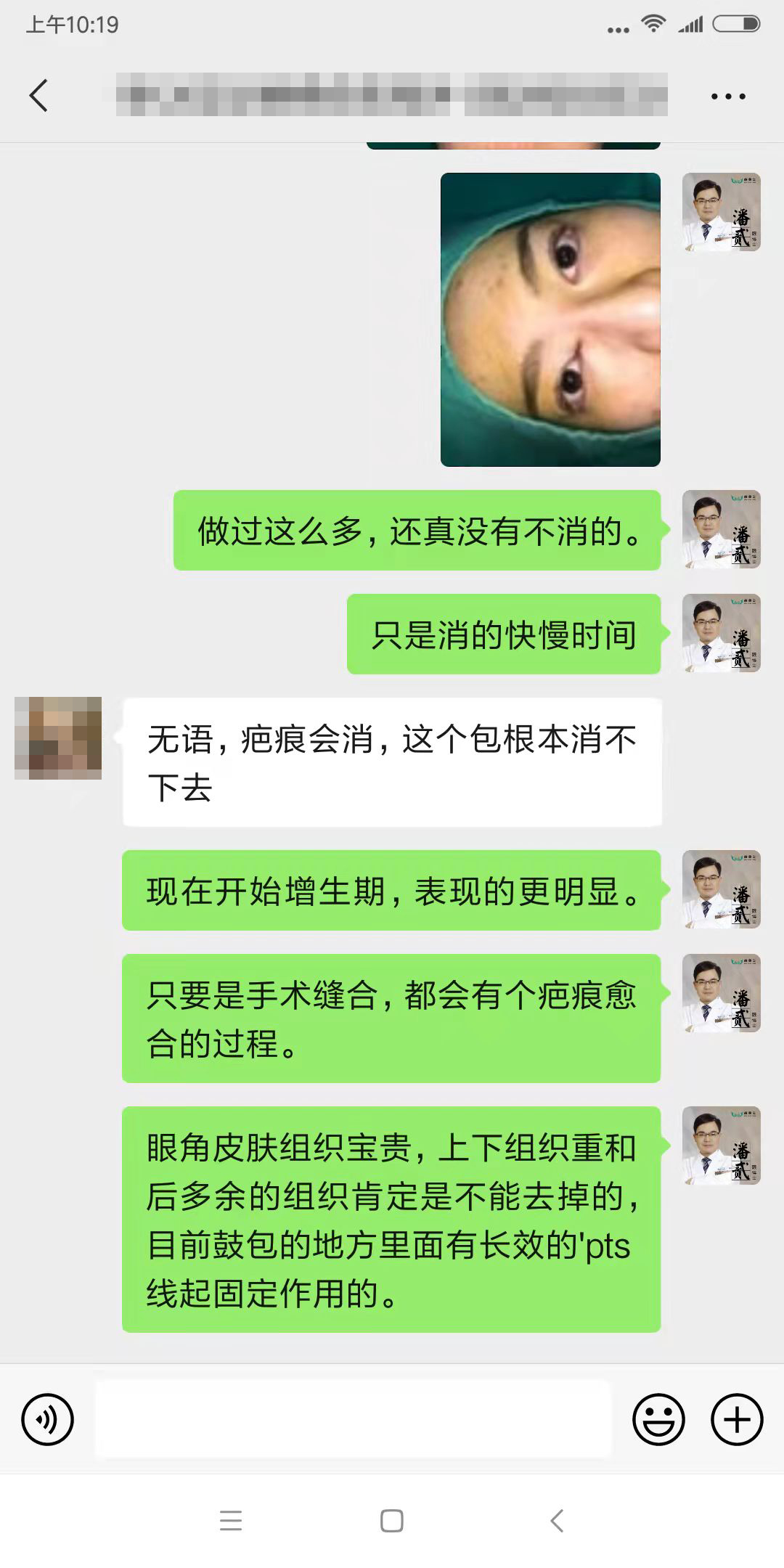 四川女子整容失败：我当初就不应该去开内外眼角，做多了只会变丑