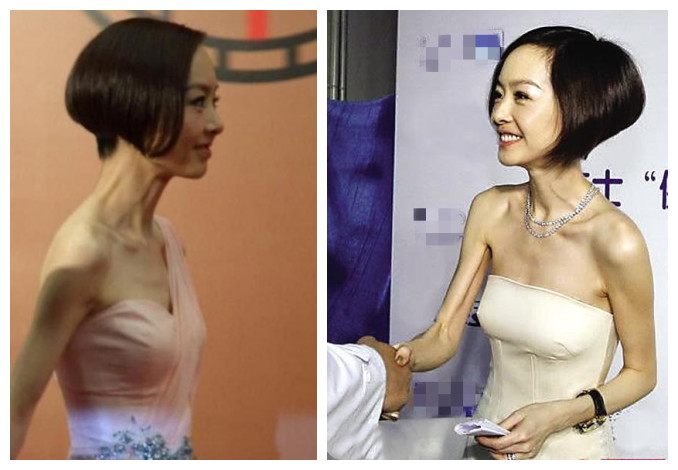 可头大身小排骨胸,女明星们瘦得这么病态也惊悚