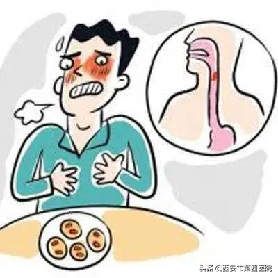 健康中国胃食管反流病(健康中国行动2030胃食管反流病如何预防？治疗方法？)