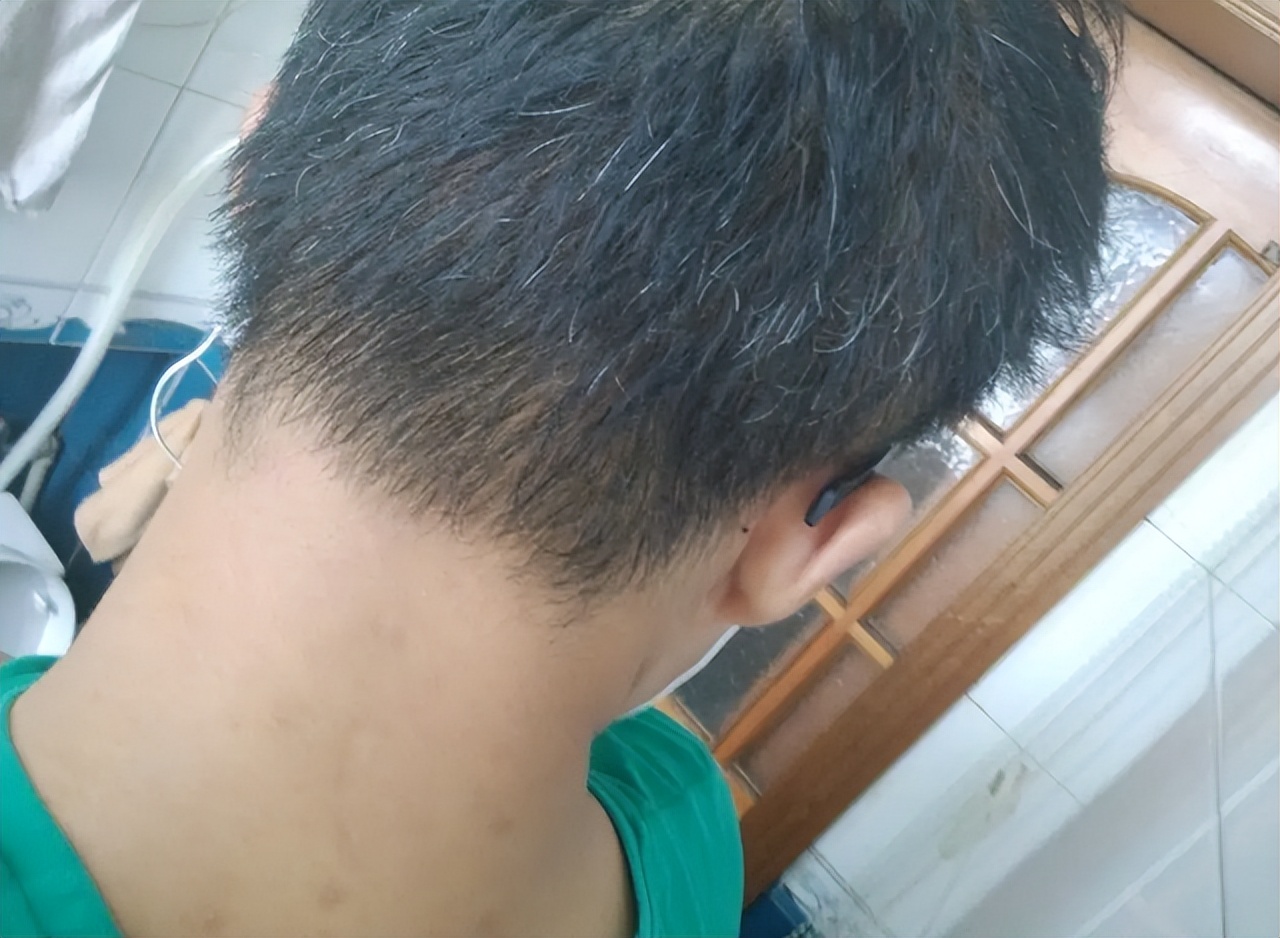 前额,两鬓,后脑勺长白发,分别代表了什么呢?