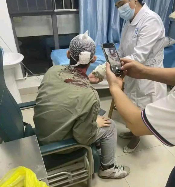 华侨大学一男学生在校刺伤女学生，大学生安全自保指南三条