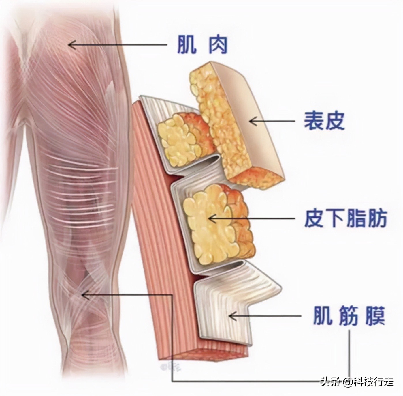 超详细 | 2022年下血本购入6款筋膜枪，全方位实测到底哪款更好