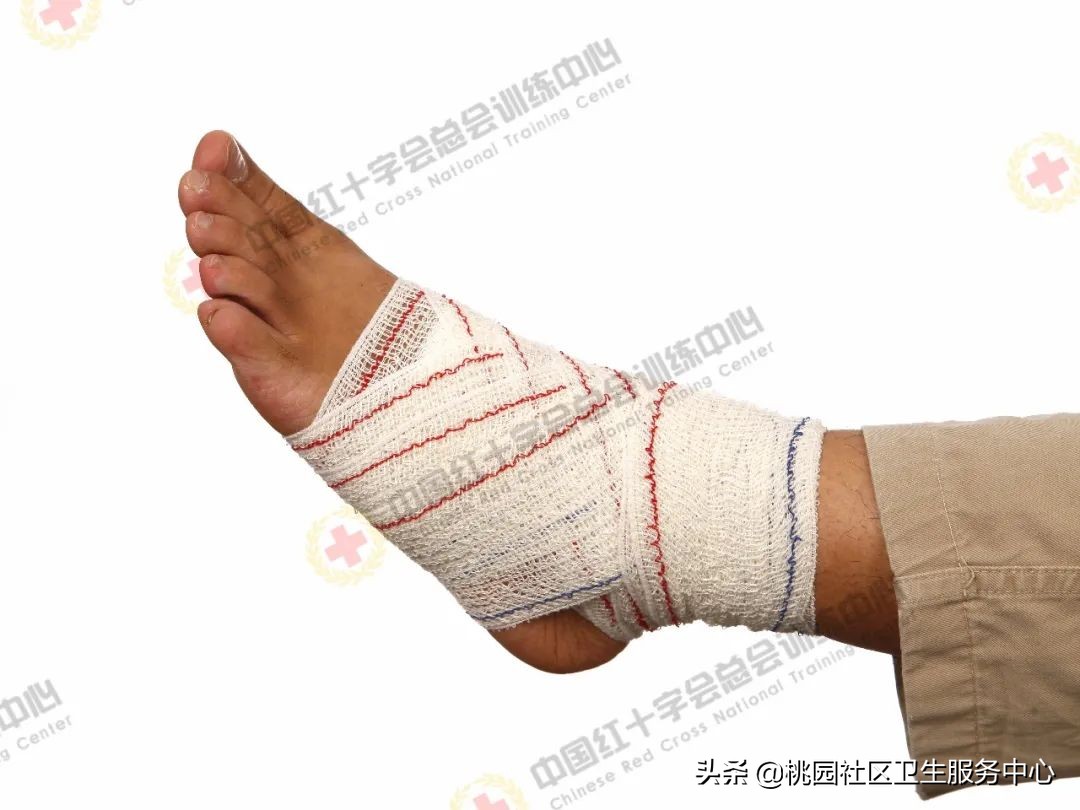 应急救护科普|现场包扎技术之绷带"8"字包扎