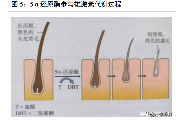 植发医疗行业专题报告：“头”等大事牵动千亿毛发市场