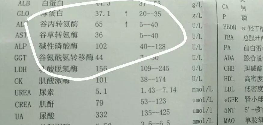 转氨酶升高该怎么办？身体会有哪些症状？肝损伤的朋友来听医生说