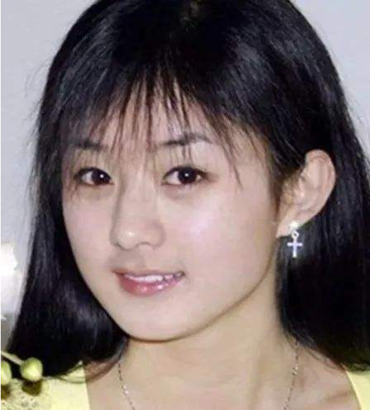 发际线太低怎么解决(发际线对女星有多重要)