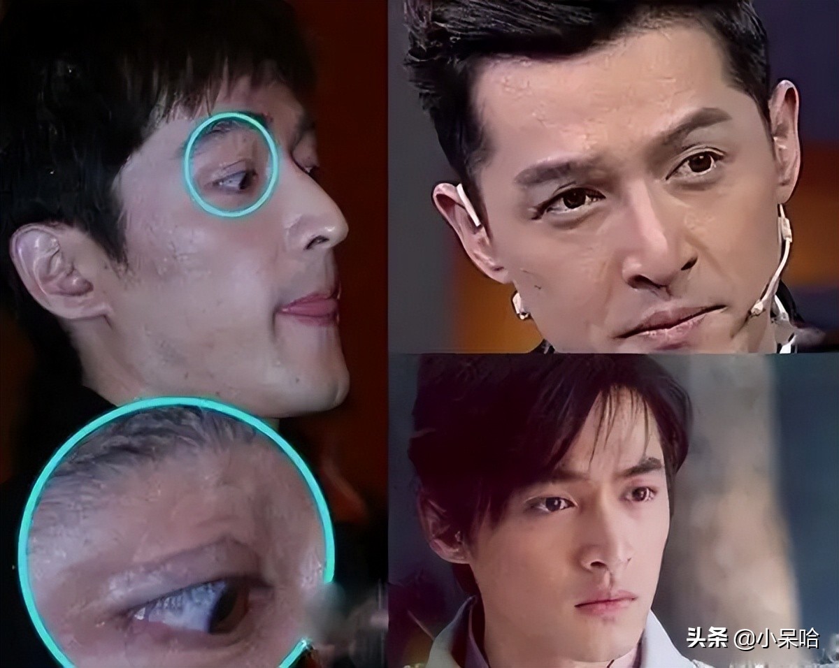 7位因拍戏深受重伤的明星，一位更比一位惨，有的至今没痊愈