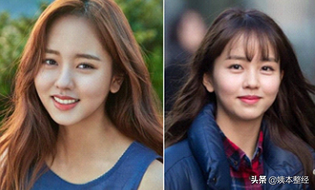 三个显土的长相特征，你中了几个？