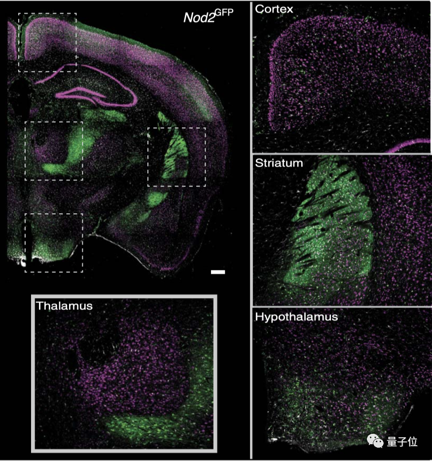 大腦能直接和腸道菌群對話，這種機制受損容易吃個不停｜Science