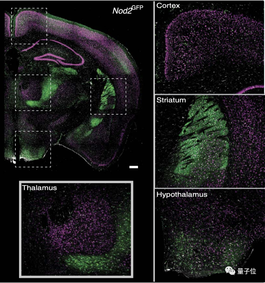 大脑能直接和肠道菌群对话，这种机制受损容易吃个不停｜Science