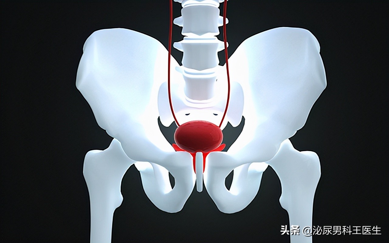 前列腺钙化详解，钙化是怎么引发的？有什么表现？怎么治疗？