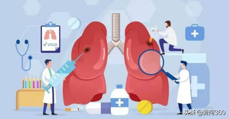 肺结节到底什么原因引发的？了解几个产生的原因，提前避免和预防