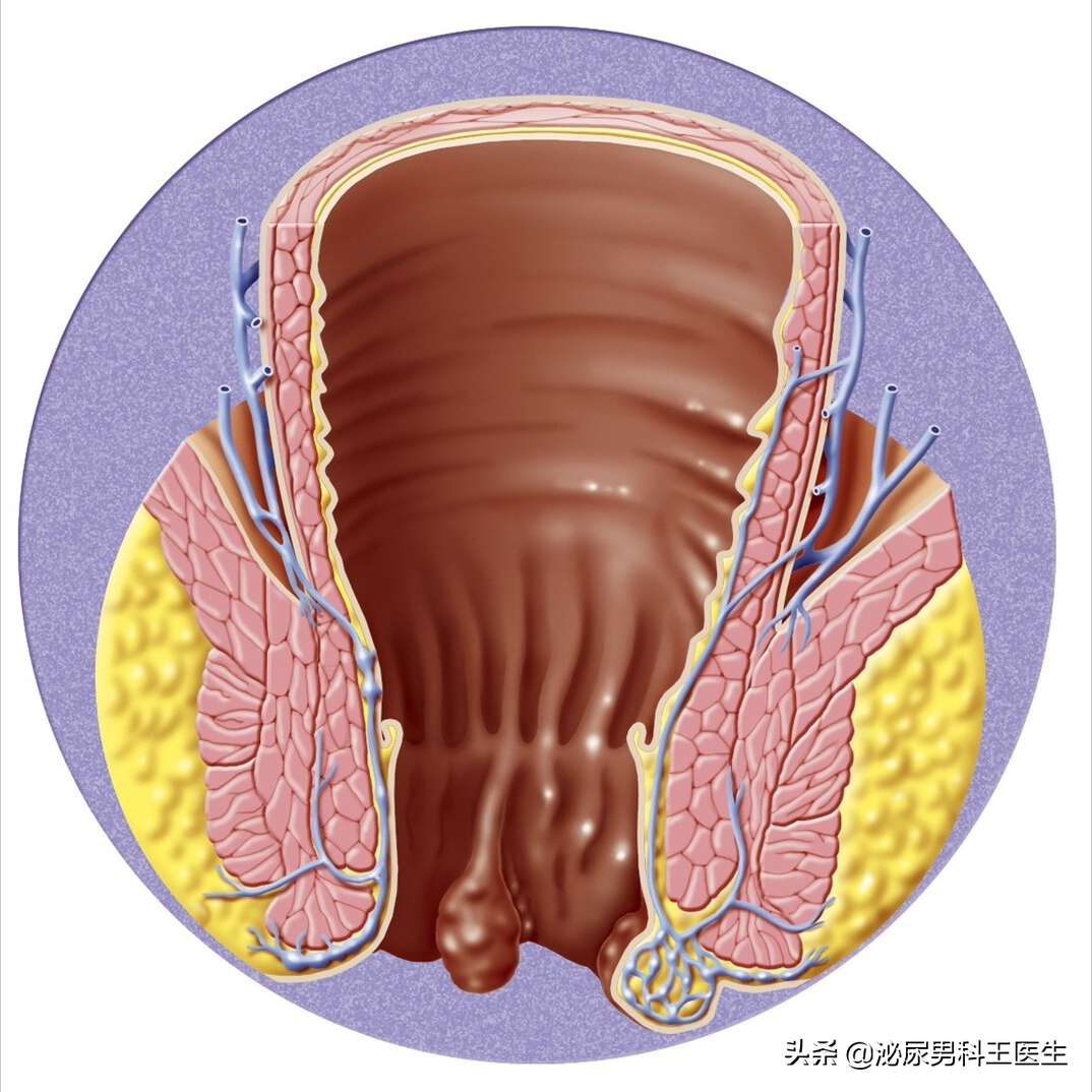 肛瘘患者：“不想治了，我真的太痛了！”肛瘘手术到底有多痛？