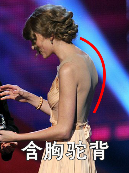 女生驼背与不驼背气质对比(驼背和不驼背的女生气质差距有多大?