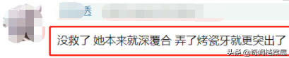 因烤瓷牙扼杀灵气的明星：林允被吐槽、热巴颜值下降，像老了10岁