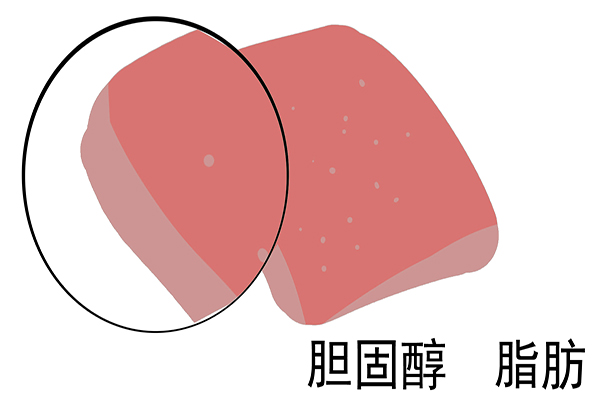 一种食物早该进黑名单，摄入量每增加2%，就增加23%严重疾病