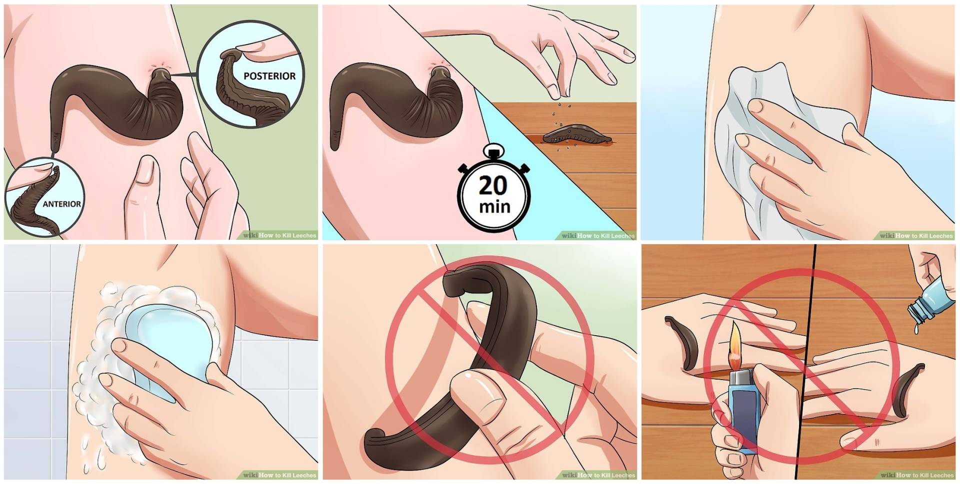 隐私部位也能寄生！女人宫颈口被水蛭寄生，医生：从隐私部位进入