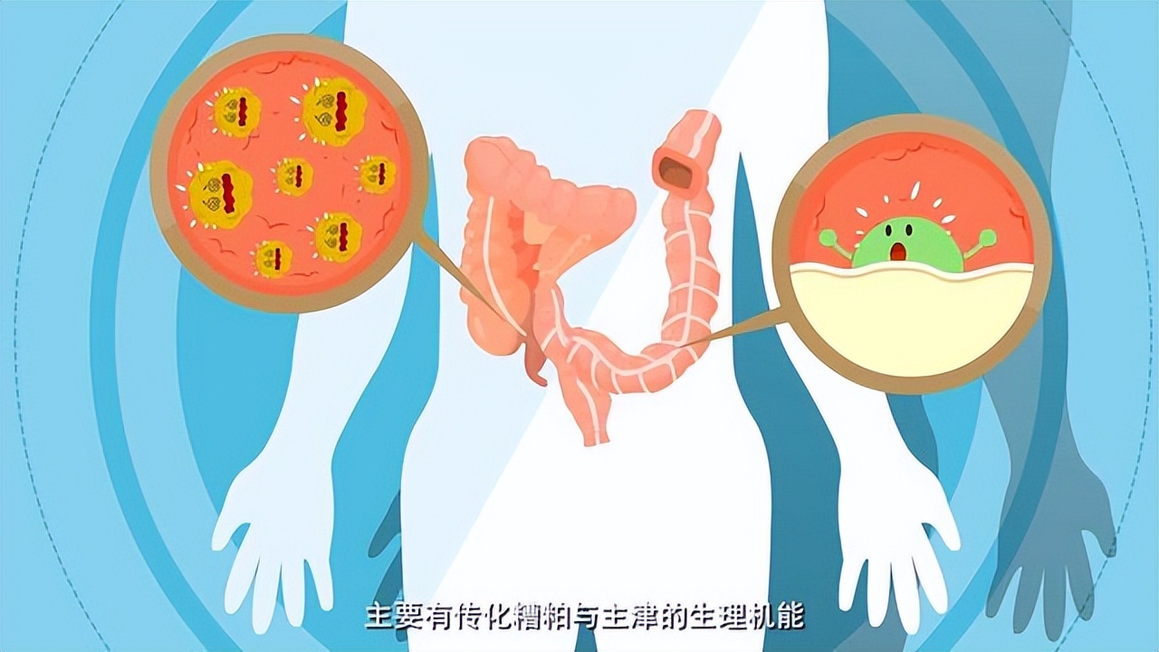 吃什么能预防肠癌？为你总结：饮食上，3少吃，2多吃，不妨了解下