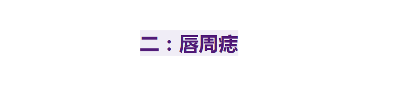 右脸有痣(别再乱动脸上的痣了，如果你脸上这4个部位有痣，到老都优雅)