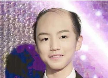 如果明星秃顶了，你还觉得他们帅吗？