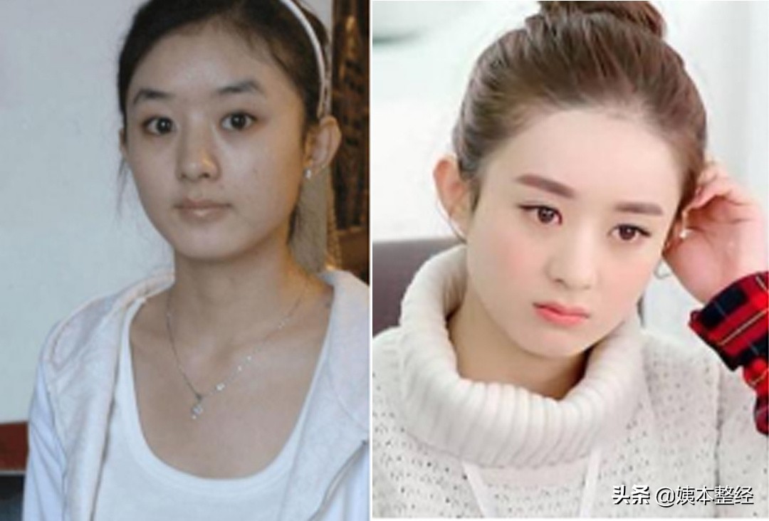 三个显土的长相特征，你中了几个？